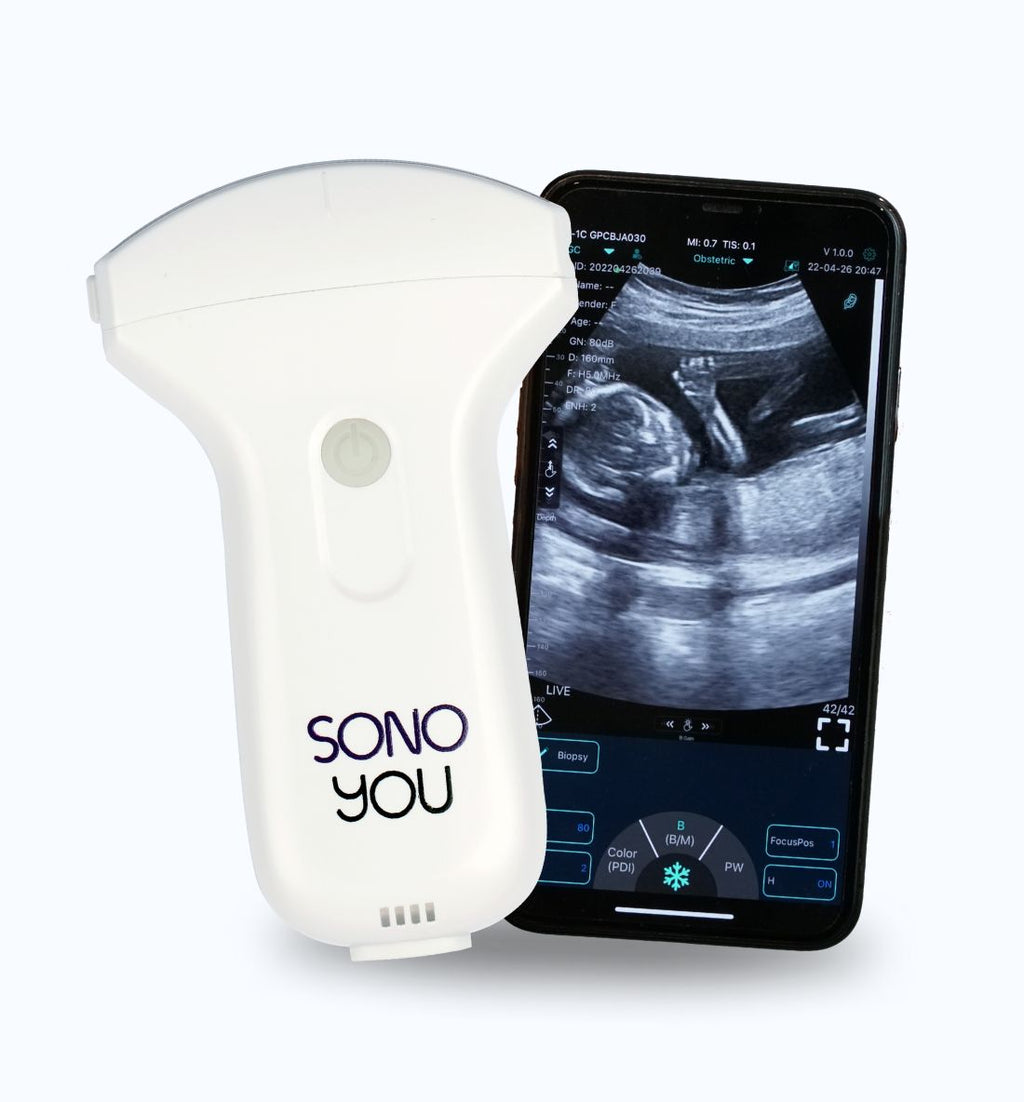 Ecógrafo portátil XP-2