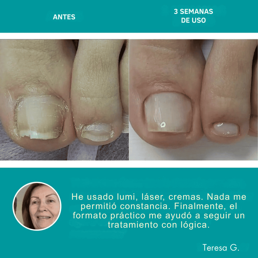 Parche Nocturno para el Cuidado de Uñas