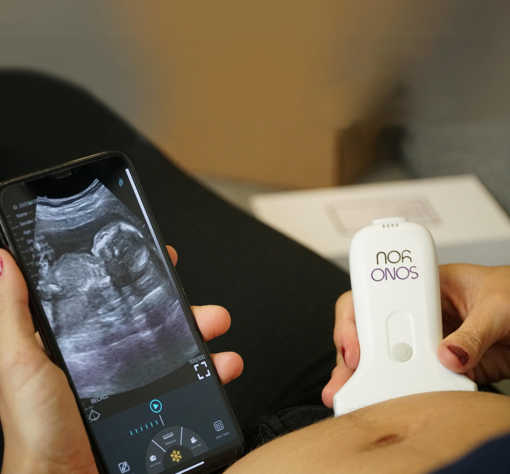 Ecógrafo portátil XP-2